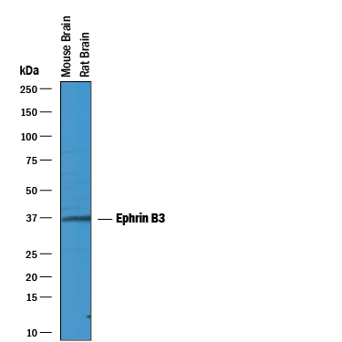 Western blot shows lysates of mouse brain tissue and rat brain tissue. PVDF membrane was probed with 1 µg/mL of Goat Anti-Human Ephrin‑B3 Antigen Affinity-purified Polyclonal Antibody (Catalog # AF395) followed by HRP-conjugated Anti-Goat IgG Secondary Antibody (Catalog # HAF019). A specific band was detected for Ephrin‑B3 at approximately 36 kDa (as indicated). This experiment was conducted under reducing conditions and using Immunoblot Buffer Group 1.