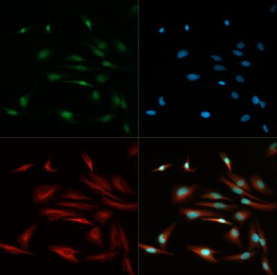 Immunocytochemistry/Immunofluorescence: TCF7L2 Antibody [NBP1-19083] - TCF7L2 antibody was tested in Hela cells with DyLight 488 (green). Nuclei and alpha-tubulin were counterstained with DAPI (blue) and Dylight 550 (red).