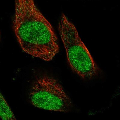 Immunocytochemistry/Immunofluorescence: PSMC3IP Antibody [NBP1-92301] - Staining of human cell line U-251 MG shows localization to nucleoplasm.