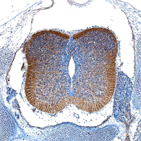 FGF‑10 was detected in immersion fixed frozen sections of mouse embryo (E13) using Sheep Anti-Mouse FGF-10 Antigen Affinity-purified Polyclonal Antibody (Catalog # AF6224) at 5 µg/mL overnight at 4 °C. Tissue was stained using the Anti-Sheep HRP-DAB Cell & Tissue Staining Kit (brown; Catalog # CTS019) and counterstained with hematoxylin (blue). Specific staining was localized to developing spinal cord. View our protocol for Chromogenic IHC Staining of Frozen Tissue Sections.