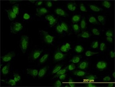 Immunocytochemistry/Immunofluorescence: FOXR2 Antibody (2C1) [H00139628-M01] - Analysis of monoclonal antibody to FOXR2 on HeLa cell. Antibody concentration 10 ug/ml.