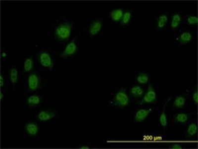 Immunocytochemistry/Immunofluorescence: TIP120A Antibody (5D7) [H00055832-M01] - Analysis of monoclonal antibody to CAND1 on HeLa cell. Antibody concentration 10 ug/ml.
