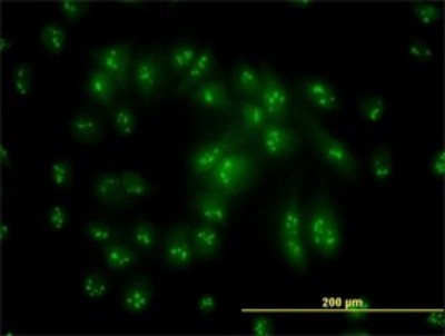 Immunocytochemistry/Immunofluorescence: PSMC6 Antibody (2C4) [H00005706-M02] - Analysis of monoclonal antibody to PSMC6 on HeLa cell. Antibody concentration 10 ug/ml.