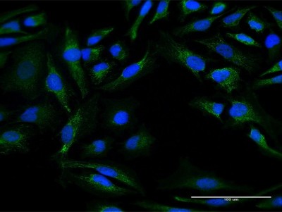 Immunocytochemistry/Immunofluorescence: DNAJC30 Antibody [H00084277-B01P] - Analysis of purified antibody to DNAJC30 on HeLa cell. (antibody concentration 10 ug/ml)
