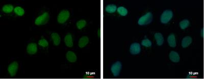 Immunocytochemistry/Immunofluorescence: PRDM4 Antibody [NBP2-19926] - NT2D1 cells were fixed in 4% paraformaldehyde at RT for 15 min. Green: PRDM4 protein stained by PRDM4 antibody  diluted at 1:500. Blue: Hoechst 33342 staining. Scale bar = 10 um.