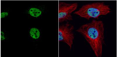 Immunocytochemistry/Immunofluorescence: PRDM4 Antibody [NBP2-19926] - HeLa cells were fixed in 4% paraformaldehyde at RT for 15 min. Green: PRDM4 protein stained by PRDM4 antibody  diluted at 1:1000. Red: alpha Tubulin, a cytoskeleton marker, stained by alpha Tubulin antibody [114]  diluted at 1:1000. Blue: Hoechst 33342 staining.