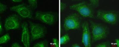 Immunocytochemistry/Immunofluorescence: PFKFB4 Antibody [NBP1-32538] - Sample: NT2D1 cells.Green: PFKFB4 protein stained by PFKFB4 antibody (NBP1-32538) diluted at 1:500.Blue: Hoechst 33342 staining.