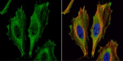 Immunocytochemistry/Immunofluorescence: ASPA Antibody [NBP1-31754] - HeLa cells were fixed in 4% paraformaldehyde at RT for 15 min. Green: Aspartoacylase protein stained by  partoacylase antibody [N1C3-2] diluted at 1:500. Red: alpha Tubulin, a cytoskeleton marker, stained by alpha Tubulin antibody  diluted at 1:1000. Blue: Hoechst 33342 staining.