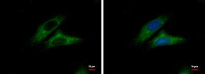 Immunocytochemistry/Immunofluorescence: CTNNAL1 Antibody [NBP1-33341] - HeLa cells were fixed in ice-cold MeOH for 5 min. Green: Alpha-catulin protein stained by Alpha-catulin antibody [N3C2], Internal diluted at 1:500. Blue: Hoechst 33342 staining.