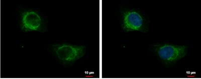 Immunocytochemistry/Immunofluorescence: Cytokeratin 71 Antibody [NBP2-17040] - HeLa cells were fixed in 4% paraformaldehyde at RT for 15 min. Green: KRT71 protein stained by KRT71 antibody [N3C3] diluted at 1:500. Blue: Hoechst 33342 staining. Scale bar = 10 um.