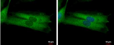 Immunocytochemistry/Immunofluorescence: MYO19 Antibody [NBP2-19450] - SK-N-SH cells were fixed in 2% paraformaldehyde/culture medium at 37  for 30 min. Green: MYO19 protein stained by MYO19 antibody [N1N2], N-term diluted at 1:500. Blue: Hoechst 33342 staining.