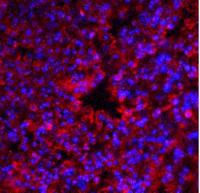 Immunocytochemistry/Immunofluorescence: PKR Antibody [NBP1-77266] - Mouse lung tissue with PKR antibody at 20 ug/ml.