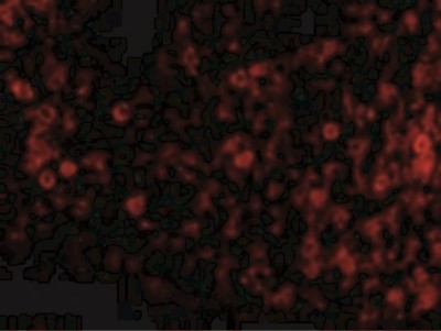 Immunofluorescence: PKR Antibody [NBP1-77266] - Immunofluorescence of PKR in Rat Lung tissue with PKR antibody at 20 ug/mL.