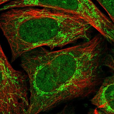 Immunocytochemistry/Immunofluorescence: RG9MTD1 Antibody [NBP1-83654] - Immunofluorescent staining of human cell line U-2 OS shows localization to nucleoplasm & mitochondria.