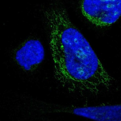 Immunocytochemistry/Immunofluorescence: DHRS3 Antibody [NBP1-80846] - Staining of human cell line U-2 OS shows localization to nucleoli & mitochondria.