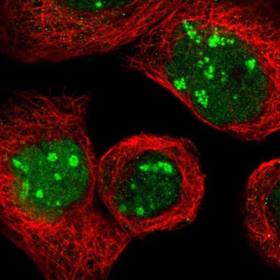 Immunocytochemistry/Immunofluorescence: NOP58 Antibody [NBP1-81681] - Immunofluorescent staining of human cell line A-431 shows localization to nucleus & nucleoli fibrillar center.
