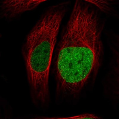 Immunocytochemistry/Immunofluorescence: ATAD2 Antibody [NBP1-84123] - Immunofluorescent staining of human cell line U-2 OS shows localization to nucleoplasm.