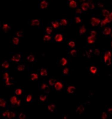 Immunocytochemistry/Immunofluorescence: BTK Antibody [NBP1-76596] - Daudi cells.