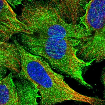 Immunocytochemistry/Immunofluorescence: PPP4R1 Antibody [NBP1-87241] - Staining of human cell line U-2 OS shows positivity in plasma membrane, cytoplasm and cytoskeleton (actin filaments).