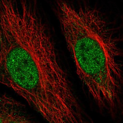 Immunocytochemistry/Immunofluorescence: RMND5B Antibody [NBP2-13234] - Immunofluorescent staining of human cell line HeLa shows localization to nucleoplasm.