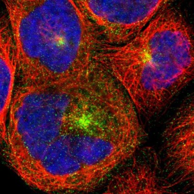 Immunocytochemistry/Immunofluorescence: HIV-1 Rev binding protein (HRB) Antibody [NBP1-91991] - Immunofluorescent staining of human cell line A-431 shows localization to vesicles.