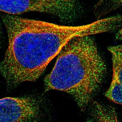Immunocytochemistry/Immunofluorescence: IPPK Antibody [NBP1-86712] - Immunofluorescent staining of human cell line U-2 OS shows localization to cytosol.