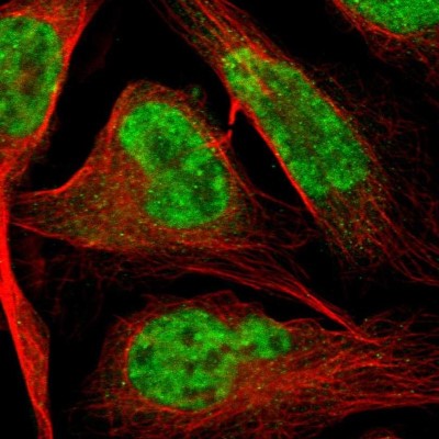 Immunocytochemistry/Immunofluorescence: HIV TAT specific factor 1 Antibody [NBP1-86966] - Immunofluorescent staining of human cell line U-2 OS shows localization to nucleoplasm.