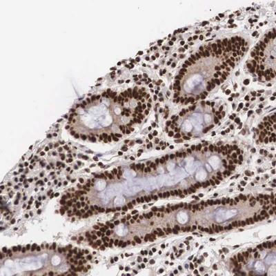 Immunohistochemistry-Paraffin: HIV TAT specific factor 1 Antibody [NBP1-86966] - Staining of human duodenum shows strong nuclear positivity in glandular cells.