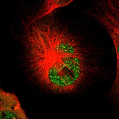 Immunocytochemistry/Immunofluorescence: PSMC3 Antibody [NBP1-86962] - Immunofluorescent staining of human cell line U-251 MG shows localization to nuclear bodies & cytosol.