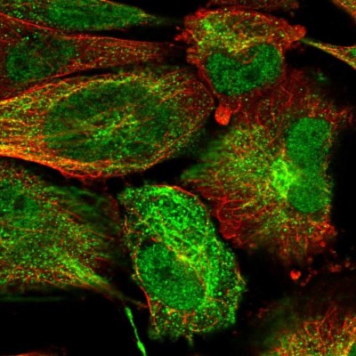 Immunocytochemistry/Immunofluorescence: KIAA0247 Antibody [NBP1-85931] - Immunofluorescent staining of human cell line U-251 MG shows localization to nucleoplasm & intermediate filaments.