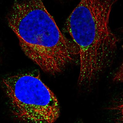 Immunocytochemistry/Immunofluorescence: LSM4 Antibody [NBP1-86846] - Immunofluorescent staining of human cell line U-2 OS shows localization to vesicles.