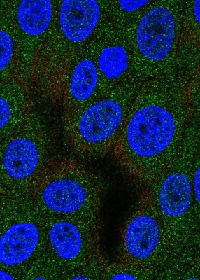 Immunocytochemistry/Immunofluorescence: Aspartyl Aminopeptidase Antibody [NBP1-91685] - Staining of human cell line MCF7 shows localization to cytosol.
