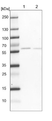 Western Blot: pre-mRNA cleavage factor I (59 kDa subunit) Antibody [NBP1-89868] - Lane 1: NIH-3T3 cell lysate (Mouse embryonic fibroblast cells). Lane 2: NBT-II cell lysate (Rat Wistar bladder tumor cells).