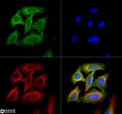 Immunocytochemistry/Immunofluorescence: VEGF R2/KDR/Flk-1 Antibody [NB100-2382] - VEGF R2/KDR/Flk-1  antibody was tested in Hela cells with DyLight 488 (green). Nuclei and alpha-tubulin were counterstained with DAPI (blue) and Dylight 550 (red).