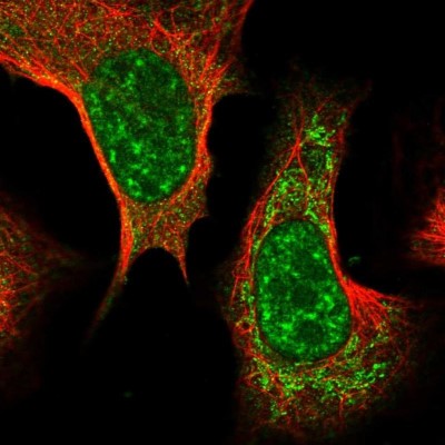 Immunocytochemistry/Immunofluorescence: PRP18 Antibody [NBP1-92297] - Staining of human cell line U-2 OS shows positivity in nucleus but not nucleoli and mitochondria.