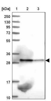 Western Blot: C19orf52 Antibody [NBP1-94151] - Lane 1: Marker  [kDa] 250, 130, 95, 72, 55, 36, 28, 17, 10.  Lane 2: Human cell line RT-4.  Lane 3: Human cell line U-251MG sp