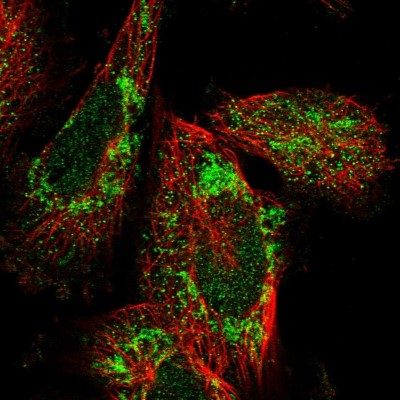 Immunocytochemistry/Immunofluorescence: C19orf52 Antibody [NBP1-94151] - Immunofluorescent staining of human cell line U-251 MG shows localization to nucleoplasm & mitochondria.