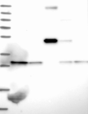 Western Blot: C19orf52 Antibody [NBP1-94151] - Lane 1: Marker  [kDa] 250, 130, 95, 72, 55, 36, 28, 17, 10.  Lane 2: Human cell line RT-4.  Lane 3: Human cell line U-251MG.  Lane 4: Human Plasma.  Lane 5: Human liver tissue.  Lane 6: Human tonsil tissue