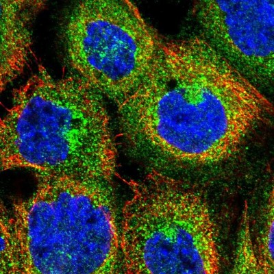 Immunocytochemistry/Immunofluorescence: DENND4C Antibody [NBP1-90788] - Immunofluorescent staining of human cell line A-431 shows localization to cytosol, the Golgi apparatus & vesicles.