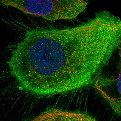 Immunocytochemistry/Immunofluorescence: Myotrophin Antibody [NBP1-89787] - Immunofluorescent staining of human cell line A-431 shows localization to plasma membrane & cytosol.