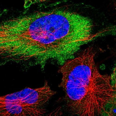 Immunocytochemistry/Immunofluorescence: ACTR6 Antibody [NBP1-89000] - Staining of human cell line U-251 MG shows positivity in plasma membrane and cytoplasm.