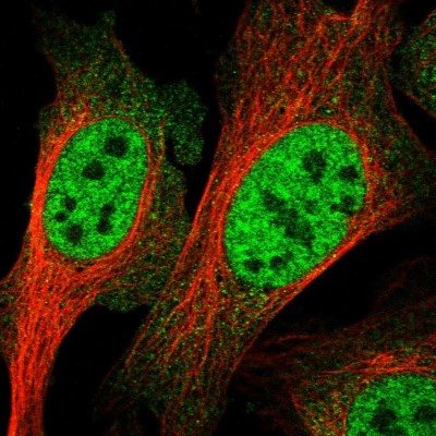Immunocytochemistry/Immunofluorescence: RENT1/UPF1/hUPF1 Antibody [NBP1-89641] - Immunofluorescent staining of human cell line U-2 OS shows localization to nucleoplasm.