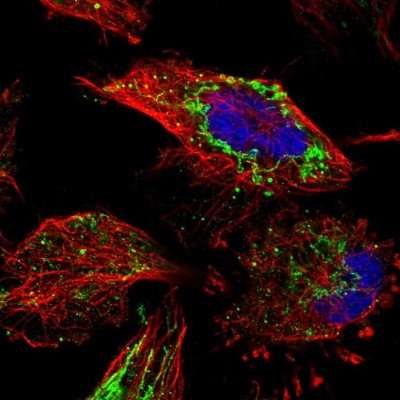 Immunocytochemistry/Immunofluorescence: ETFB Antibody [NBP1-89545] - Immunofluorescent staining of human cell line U-251 MG shows localization to mitochondria & vesicles.