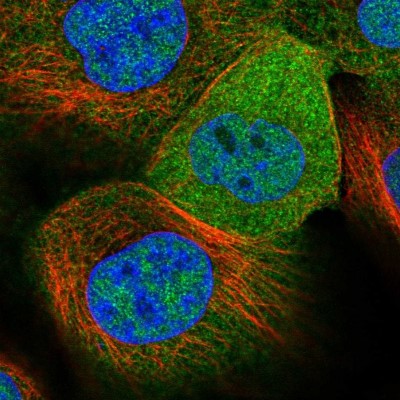 Immunocytochemistry/Immunofluorescence: GLOD4 Antibody [NBP1-88462] - Immunofluorescent staining of human cell line A-431 shows localization to nucleoplasm & cytosol.