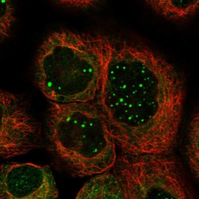 Immunocytochemistry/Immunofluorescence: UFL1 Antibody [NBP1-90692] - Staining of human cell line A-431 shows positivity in nucleus & cytoplasm.