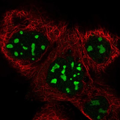 Immunocytochemistry/Immunofluorescence: BRIX Antibody [NBP1-91708] - Immunofluorescent staining of human cell line A-431 shows localization to nucleoli.