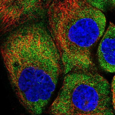 Immunocytochemistry/Immunofluorescence: HARS Antibody [NBP1-89490] - Immunofluorescent staining of human cell line A-431 shows localization to cytosol.