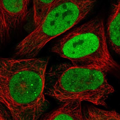 Immunocytochemistry/Immunofluorescence: RPA2 Antibody [NBP1-89524] - Staining of human cell line U-2 OS shows localization to nucleoplasm & nuclear bodies.