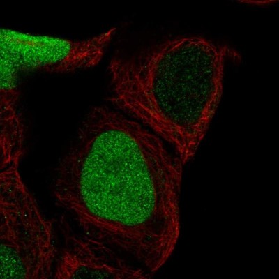 Immunocytochemistry/Immunofluorescence: CDCA5 Antibody [NBP1-89530] - Immunofluorescent staining of human cell line A-431 shows localization to nucleoplasm.