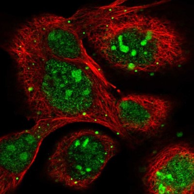 Immunocytochemistry/Immunofluorescence: HSPC111 Antibody [NBP1-89659] - Immunofluorescent staining of human cell line A-431 shows localization to nucleus, nucleoli & vesicles.